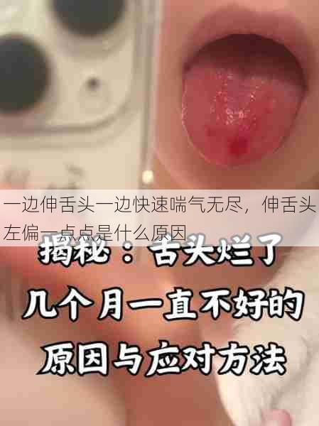 一边伸舌头一边快速喘气无尽,伸舌头左偏一点点是什么原因 第1张 一边伸舌头一边快速喘气无尽,伸舌头左偏一点点是什么原因 第1张